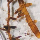 Hongos y bacterias IDForest